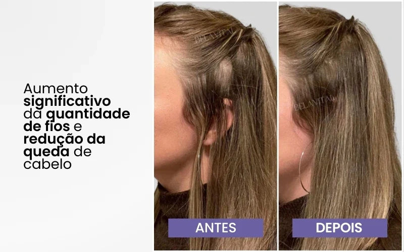 Escova TheraBrush Pro- Escova Anti Queda 4 em 1 [FIM DA QUEDA DE CABELO]